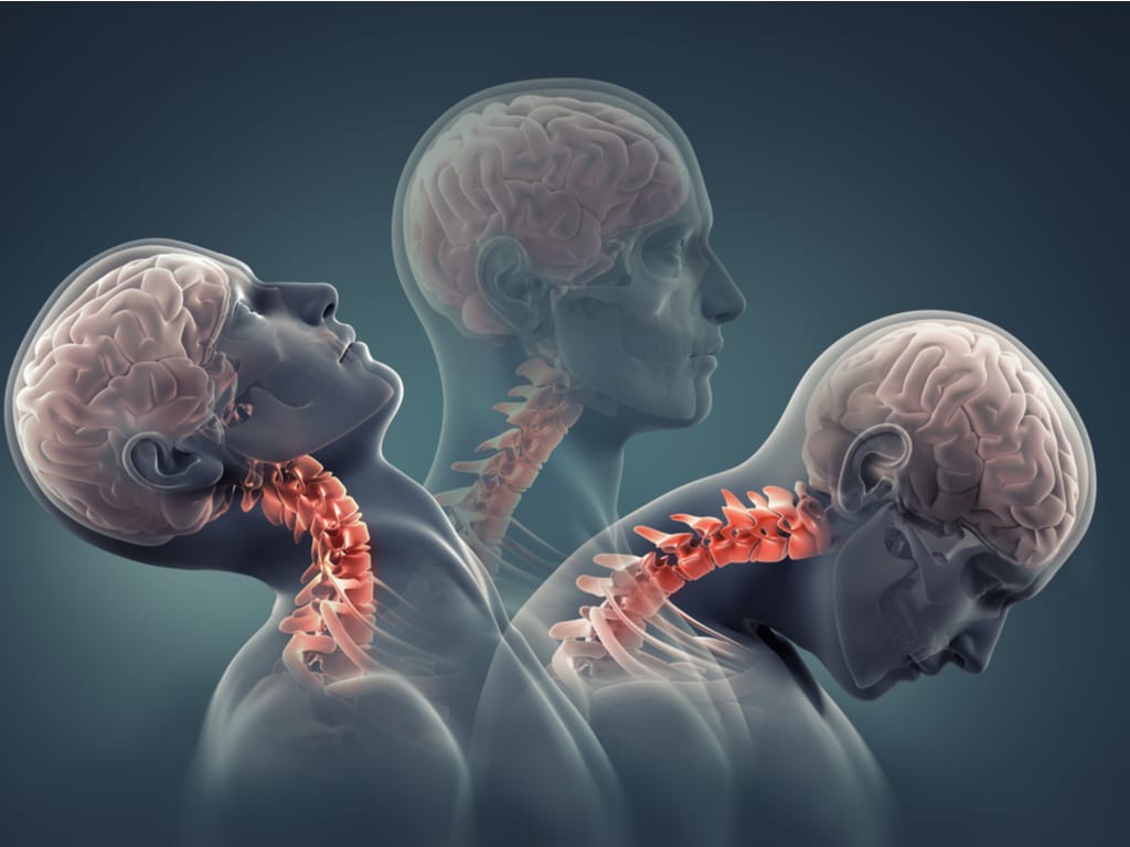 how-long-does-neck-pain-last-after-a-car-accident-metro-health-nyc